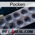 Poxet 30